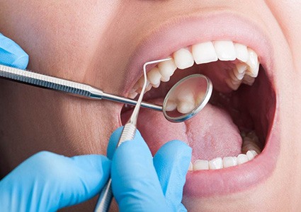 Dentist looking at teeth with a mirror