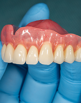 Dentist holding a denture