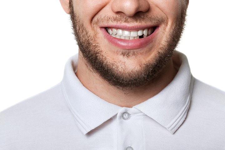 A man missing a tooth near Old Towne